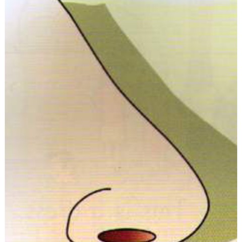 Example 1: nose