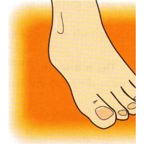 Example 2: foot